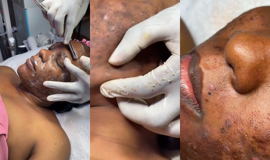 classicskintherapist TikTok Live — Jul 15, 2026, 11:29 AM